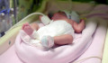 Több mint hét kilóval született egy csecsemő Ukrajnában