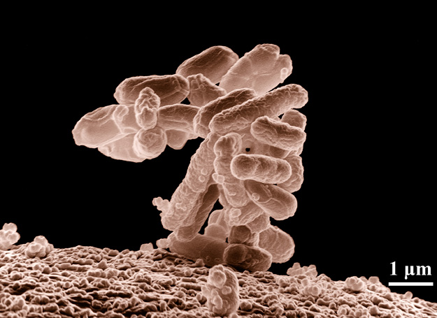 E. coli baktérium