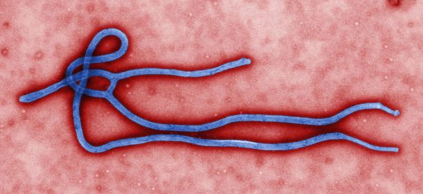 Transzmissziós elektronmikroszkóppal készült és utólagosan színezett felvétel az Ebola-vírus virionjáról