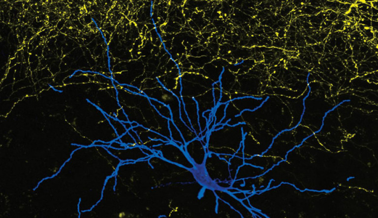 Komoly eredményeket értek el az ELTE kutatói az Alzheimer- és a Parkinson-kór gyógyíthatóságáért végzett kutatásaik során