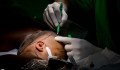 Sikeresen lezajlott a fejüknél összenőtt sziámi ikrek második műtéte a Semmelwies Egyetemen