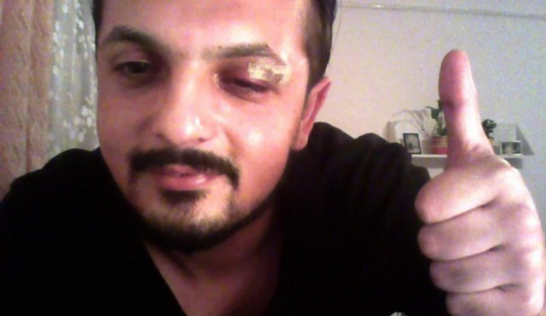 Garázdaság miatt nyomoz a rendőrség az arabnak nézett és emiatt megtámadt cigány újságíró ügyében