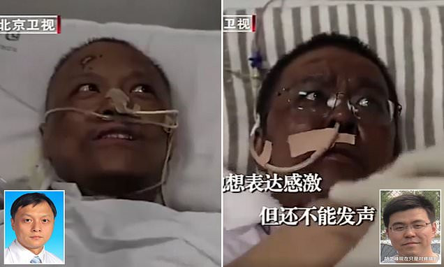 Két vuhani orvos bőre elszíneződött, mire felgyógyultak a koronavírus-fertőzésből